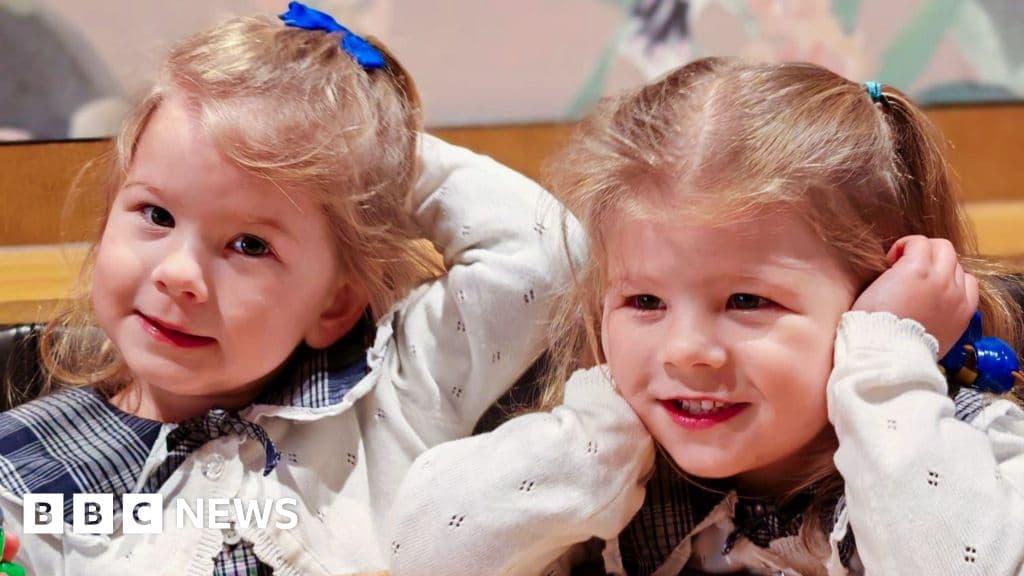 World-first non-invasive treatment saves identical twins from rare pregnancy condition
