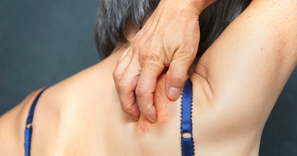 Shingles vaccine shows dementia protection in elderly adults, studies indicate