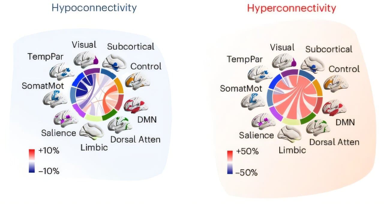 Researchers identify two distinct autism subtypes using brain connectivity patterns