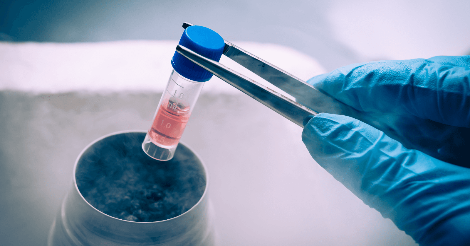 Stem cell transplant enables insulin-free remission in Type 1 diabetes patient