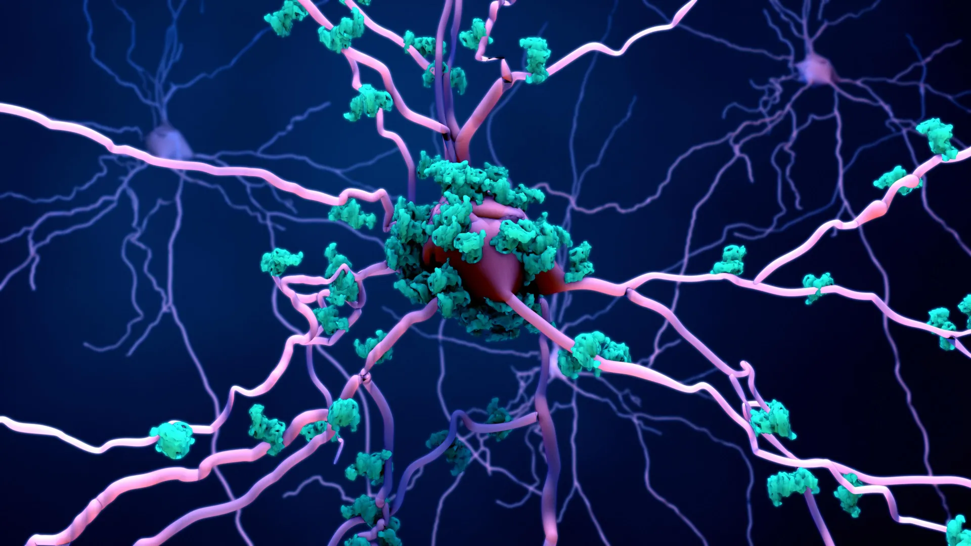 Scientists identify previously unknown brain cell death mechanism in Alzheimer's disease